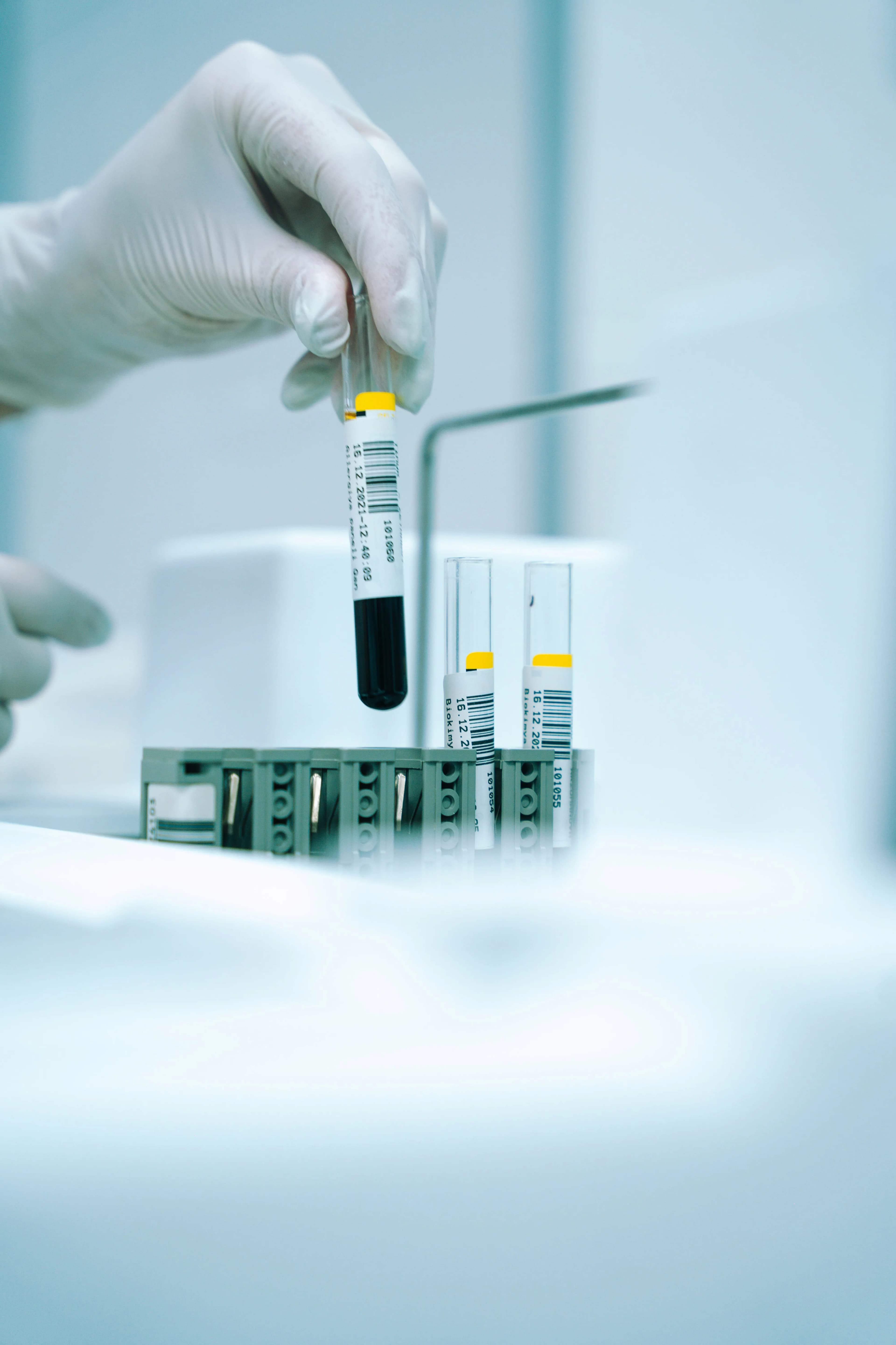 Diagnostics & Lab Tests at Home